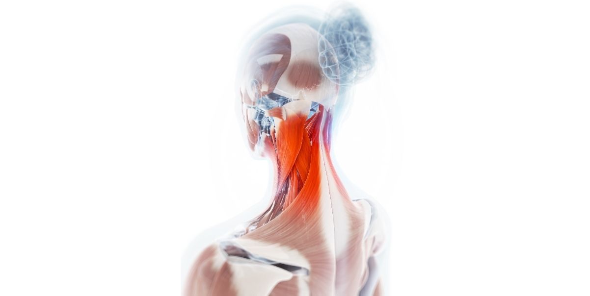 Photo of the neck and muscles that may be involved in neck pain